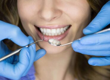 Why Can’t Teenagers Get Dental Implants?