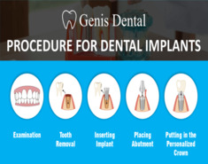 What Are The Pros And Cons Of Dental Implants