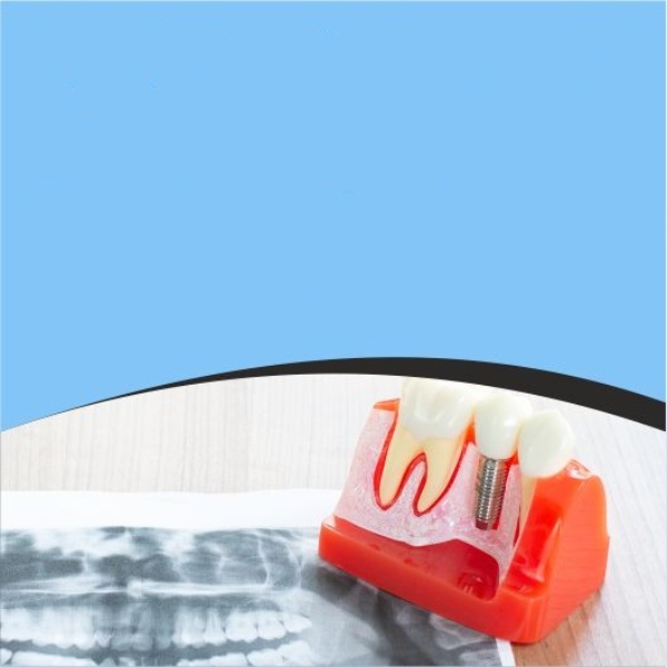 What Are The Pros And Cons Of Dental Implants?