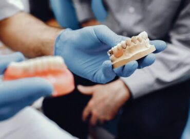 Dental Implant: End To End Discussion