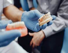 End To End Discussion On The Dental Implant Procedure