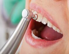 Dental Cleaning Services In Feasterville PA